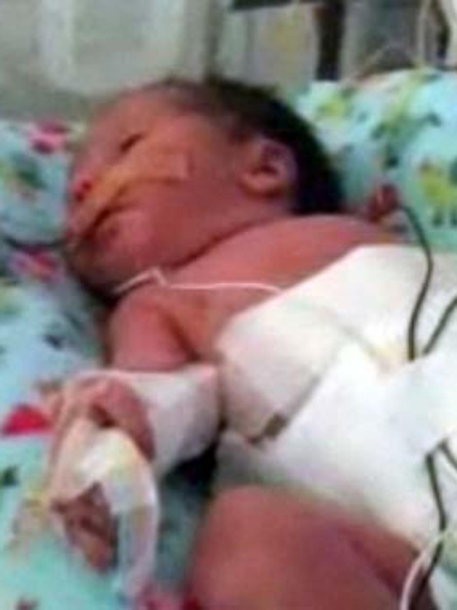 Birth defect cluster sparks investigation - ABC News