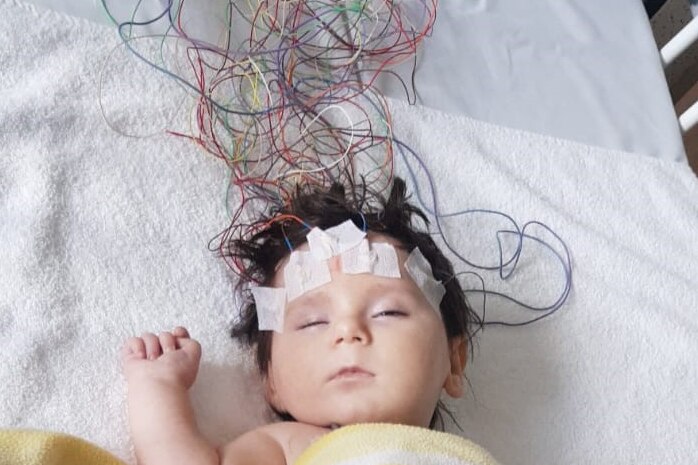 Young toddler lying  in hospital bed with lots of colourful wires attached to his head.