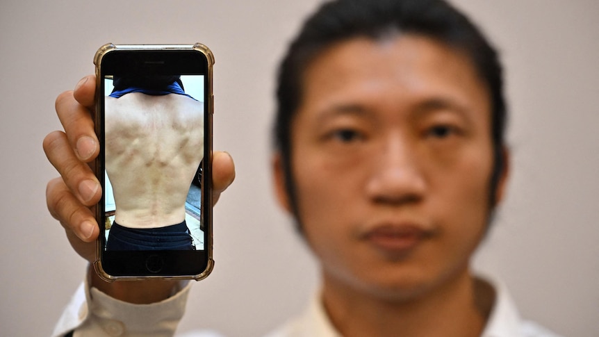 Photo shows a blurred Asian man holding a phone with a photo showing a man's bare back