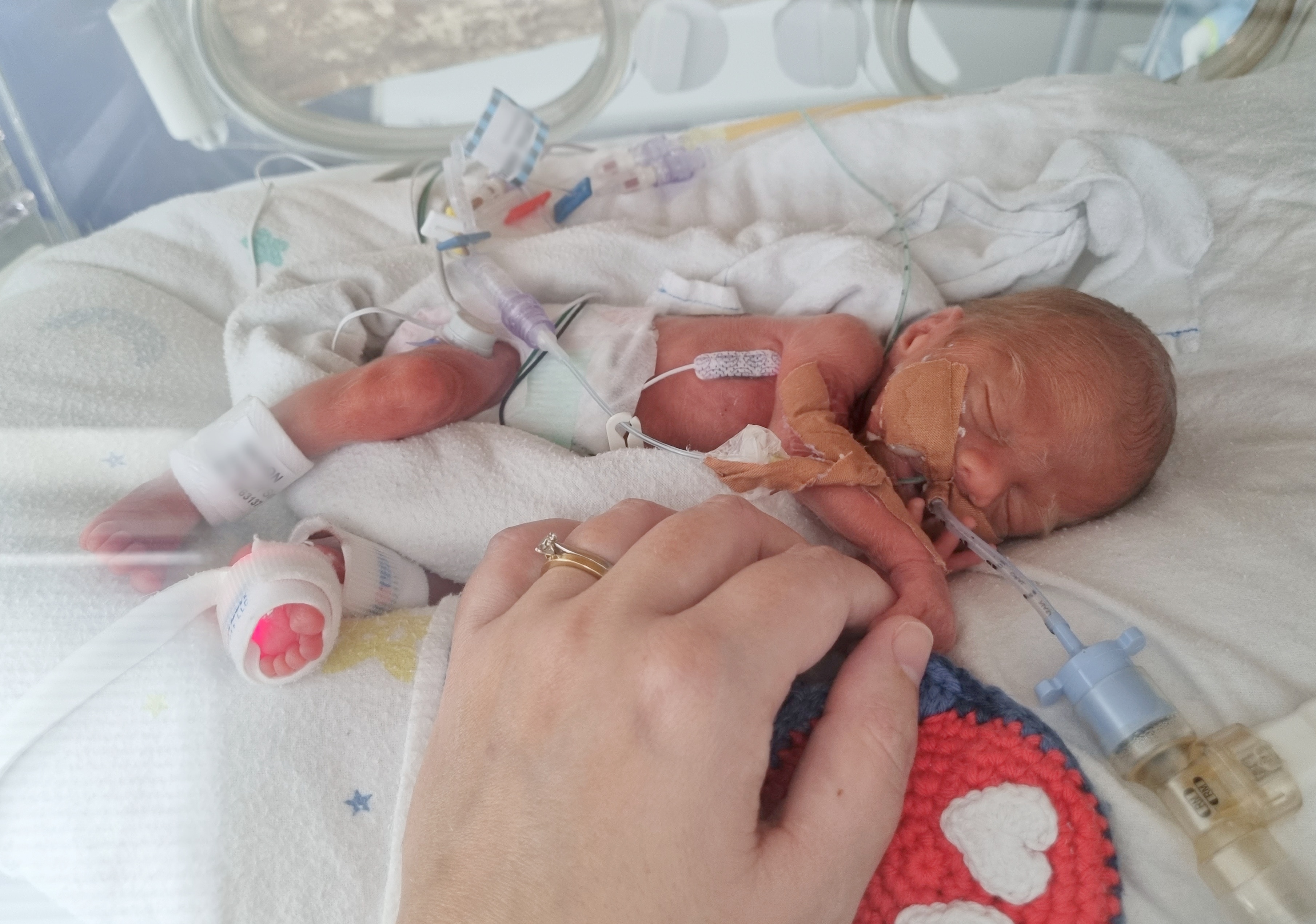 Premature baby Atticus pictured in hospital.
