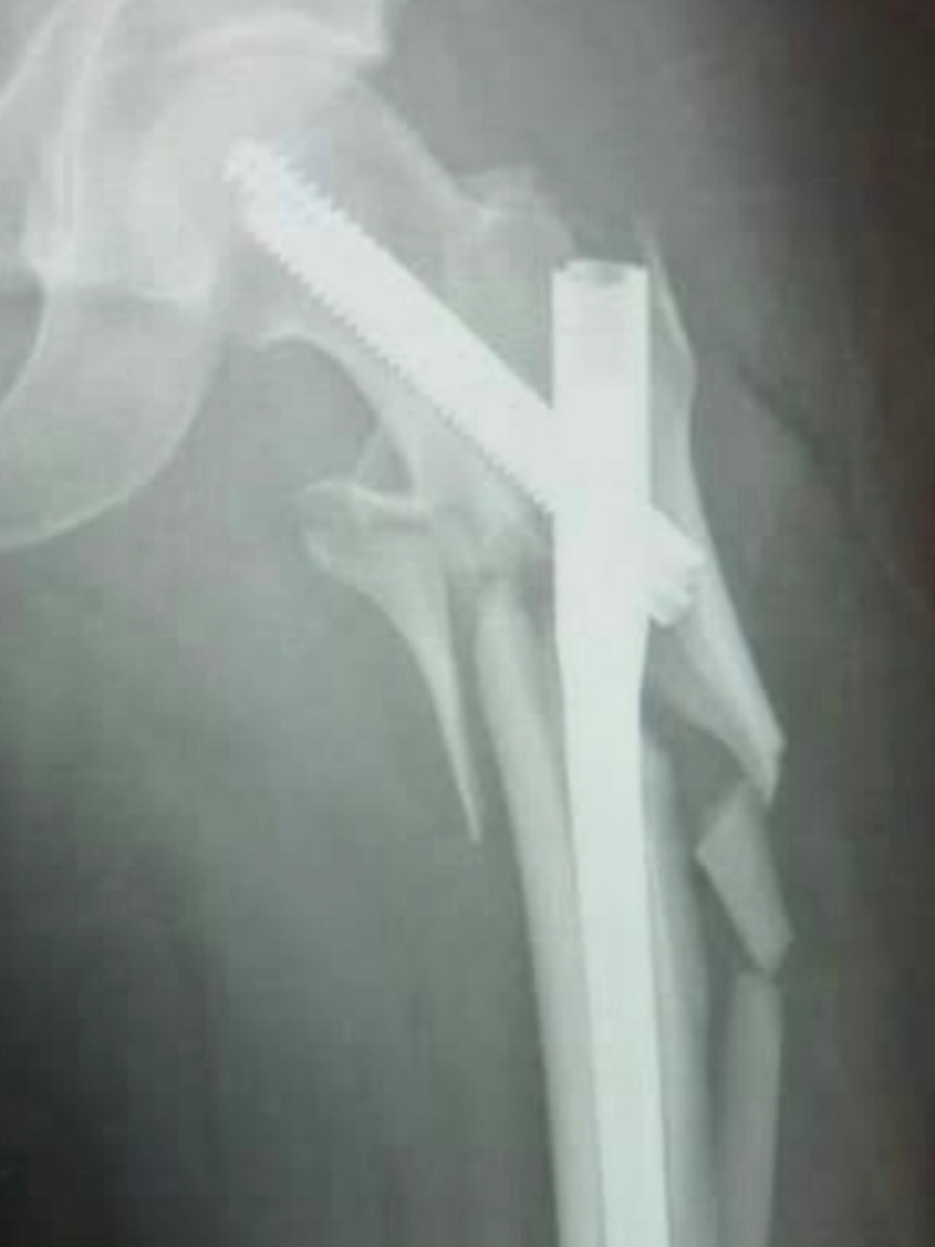 A scan shows Buddy's broken leg bones.