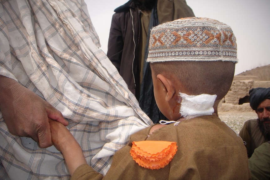 The back of a boy's head with a wound.