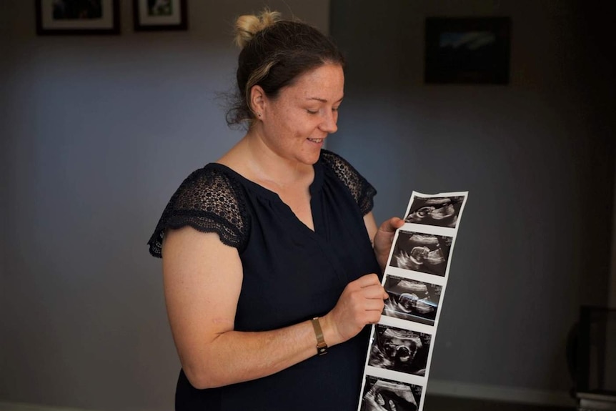 A woman wearing a black top stands indoors smiling and looking down at a string of baby scans.