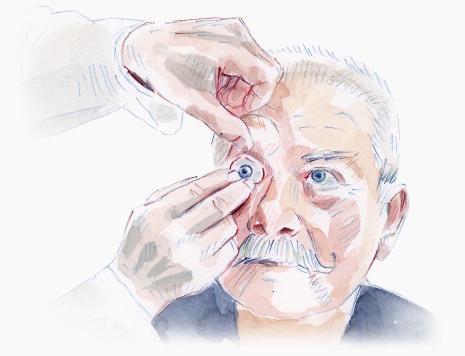 Hands placing an artificial eye into an elderly man's empty eye socket.