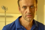 A man in a blue polo shirt with scars on his neck from being intubated.