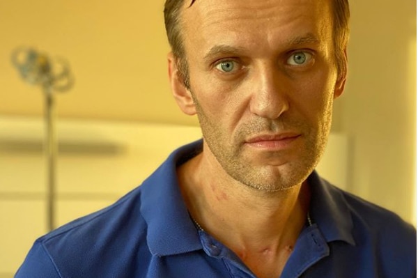 A man in a blue polo shirt with scars on his neck from being intubated.