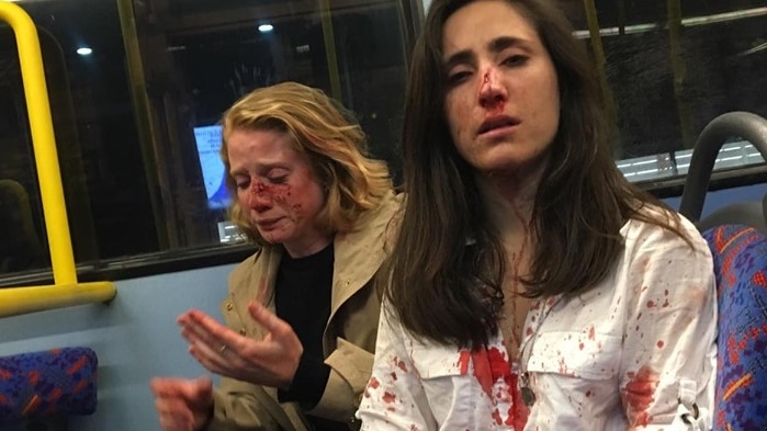 Two women sit on a bus seat with blood dripping down their faces