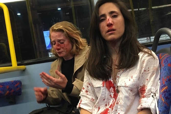 Two women sit on a bus seat with blood dripping down their faces