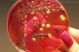 Salmonella grows in a petri dish