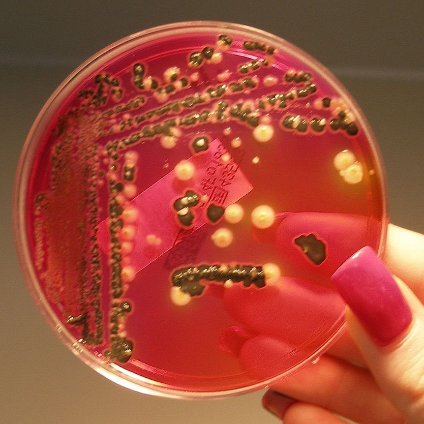 Salmonella grows on agar in petri dish