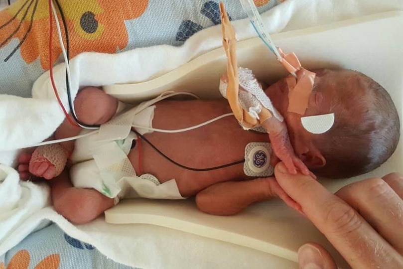 A premature baby in hospital.