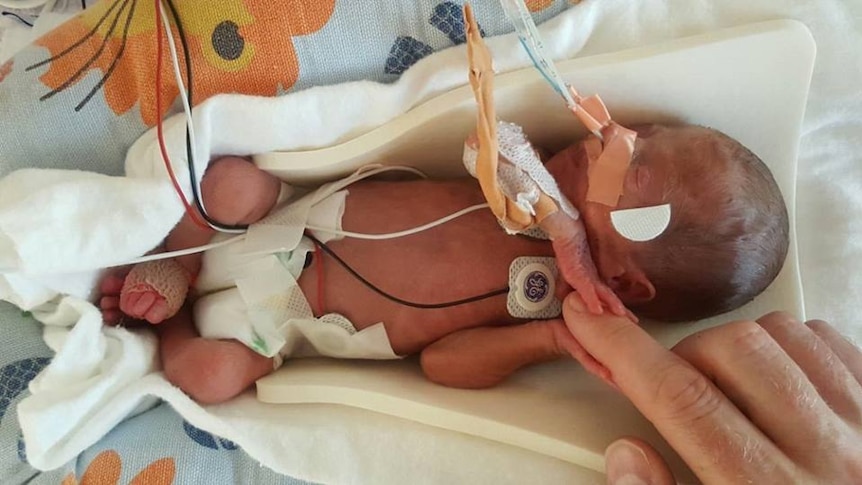 A premature baby in hospital.