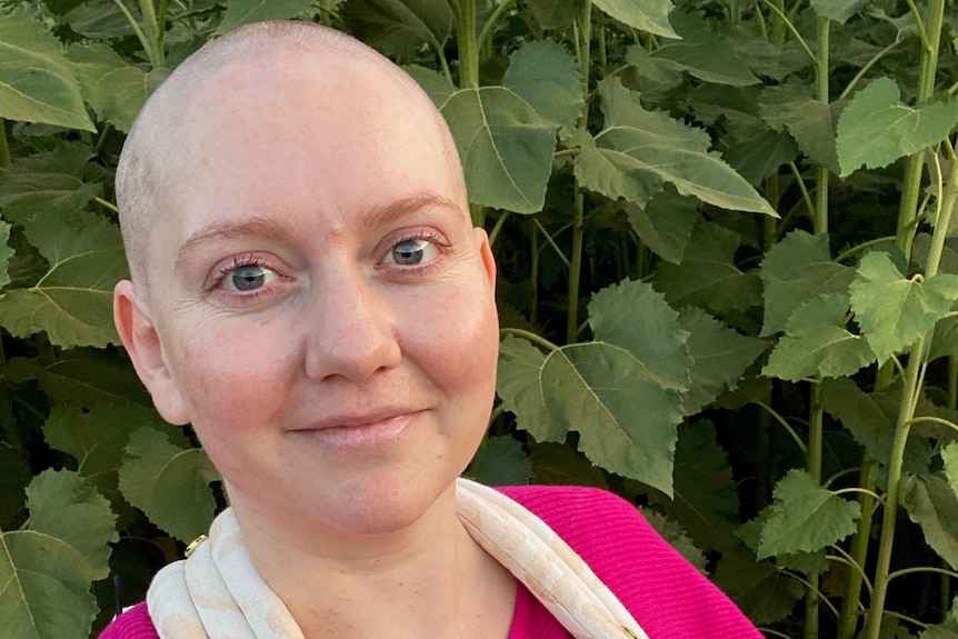 A woman with a shaved head smiles at the camera.