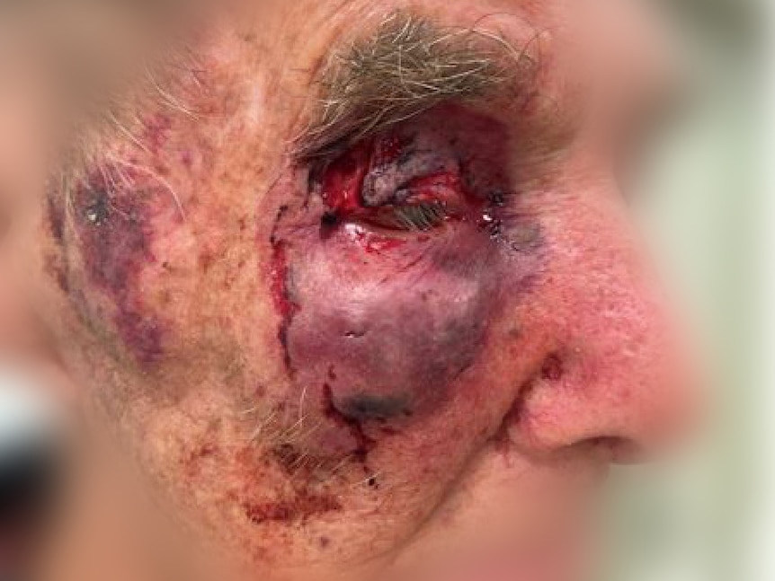 A close-up shot of an elderly man's bloodied face.