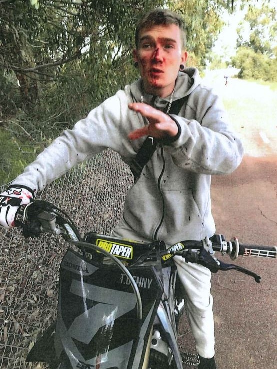Tyson Denny on his motorbike with a bloodied face.