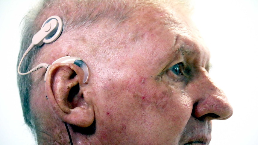 Richard Hall with his new cochlea implants