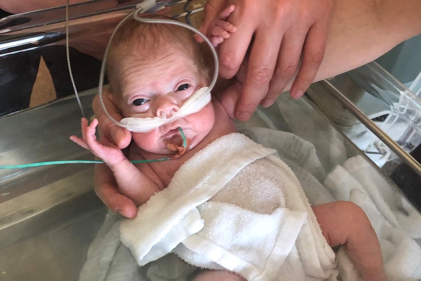 A small baby with tubes up her nose and her mouth in a hospital bed.