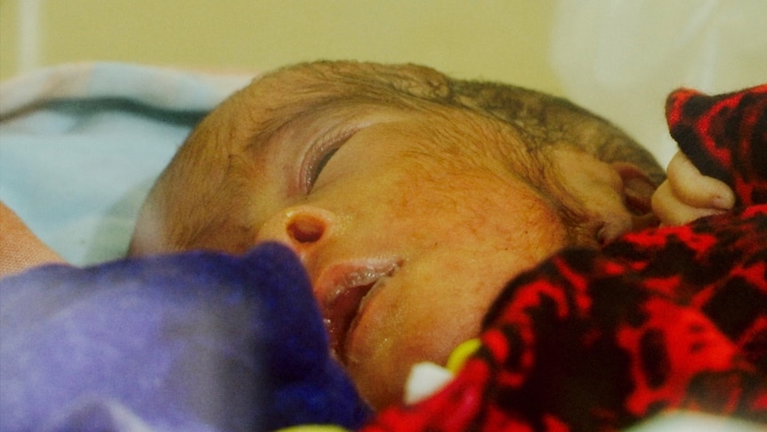 A premature baby girl in the self-declared state of Somaliland.