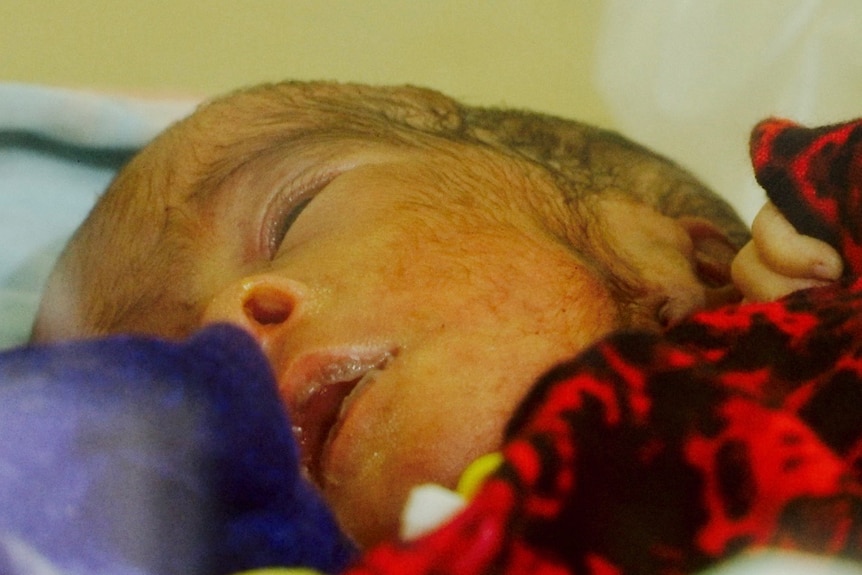 A premature baby girl in the self-declared state of Somaliland.