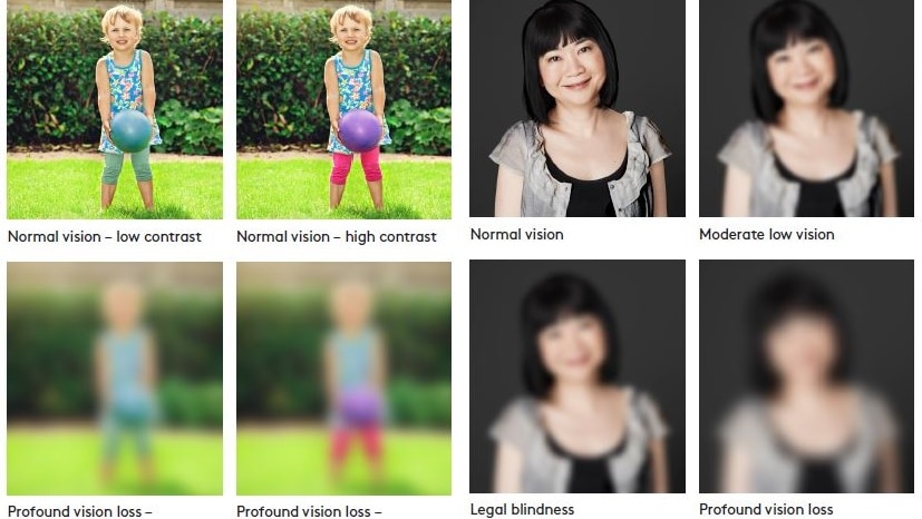 Photos showing the degree of vision loss against high and low contrasts.