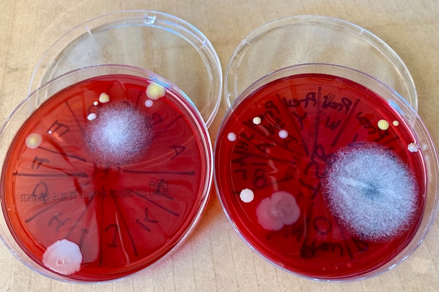Bacteria grows on two red agar plates, made from horse blood.