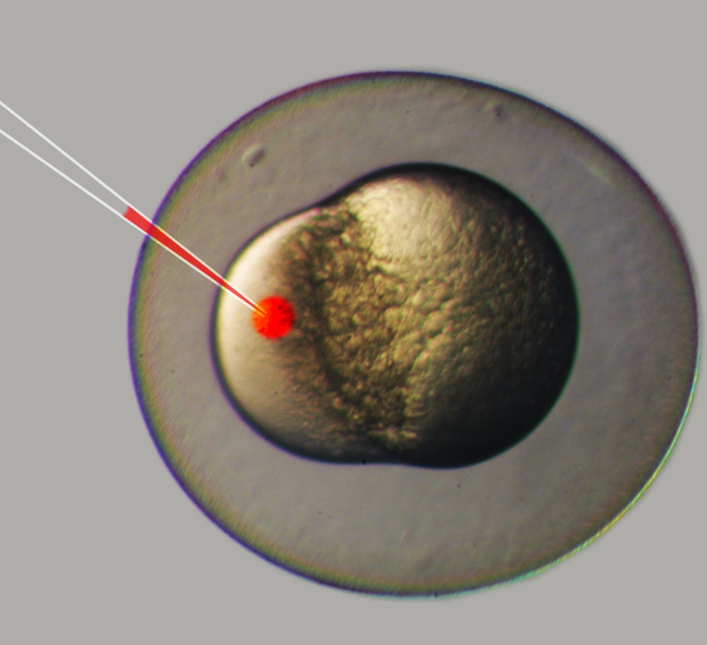 Uma única célula ejetada sob um microscópio.