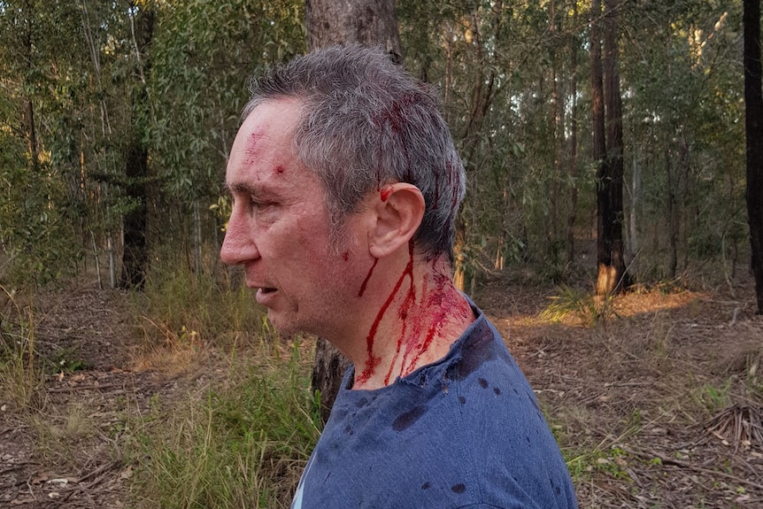 Jim Dodrill with a head injury after vicious attack