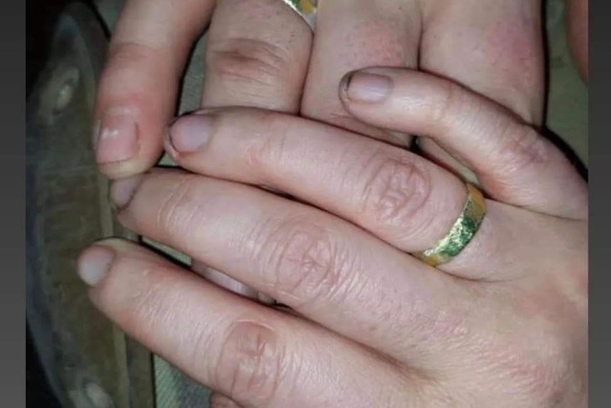 Two hands with wedding bands. 
