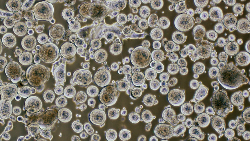 Infected covid cultures under a microscope