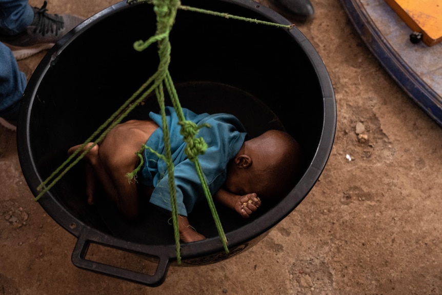 A visibly malnourished baby wearing only a teal shirt curls up inside a bucket to be weighed