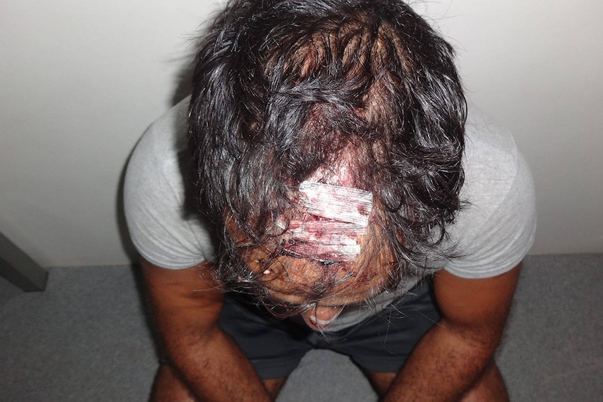 In this photograph from somebody believed to be inside the detention centre, a man shows an injury to his head
