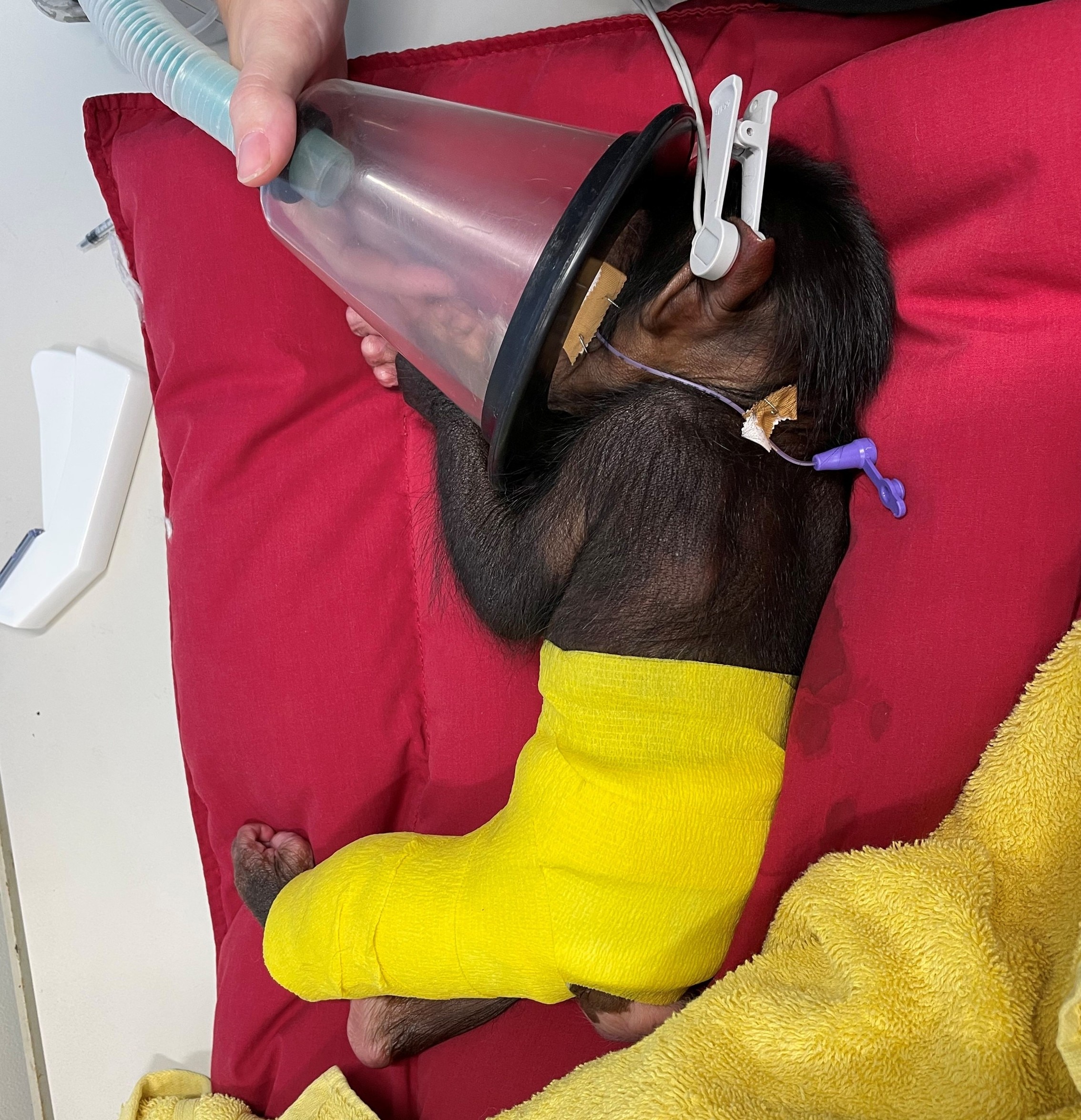 A black baby chimp lies on a red blanket with an oxygen mask pressed to her face. She wears a bright yellow cast on her leg.