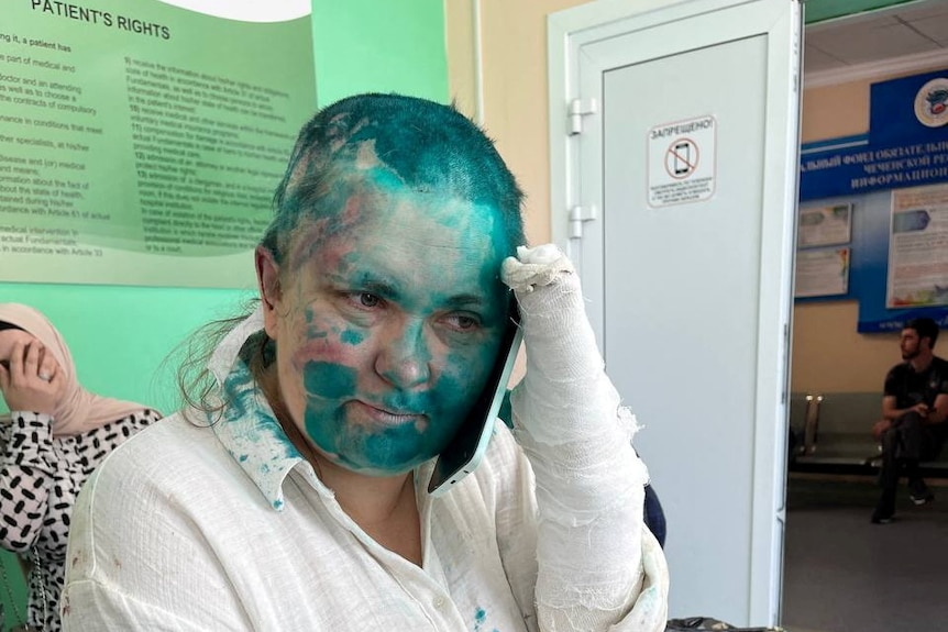 A woman covered in blue paint speaks on the phone on a hospital bed. 