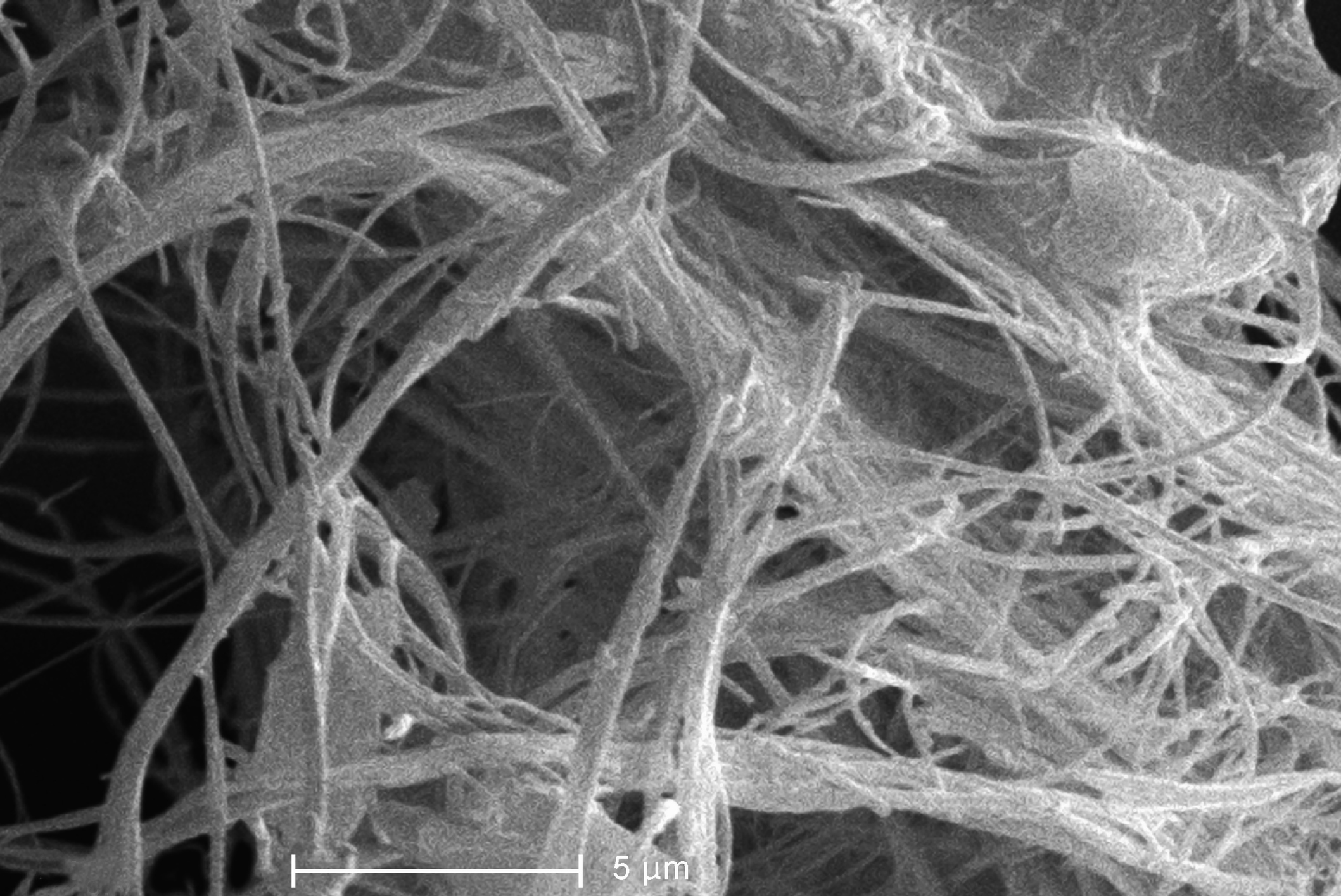 Asbestos fibres seen under an electron microscope.