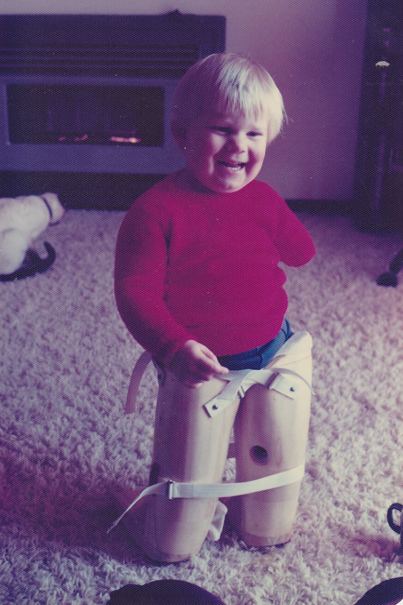 A young boy about 3 years old with prosthetic legs