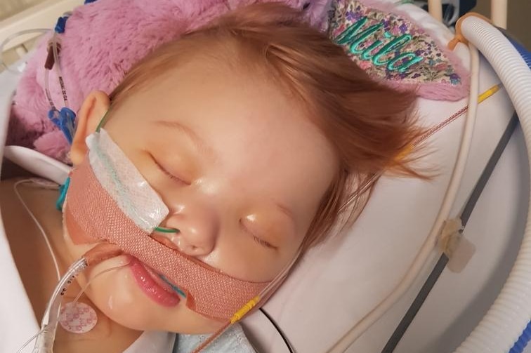 A toddler with red hair lies in a hospital bed with medical tubes in her mouth and nostril.