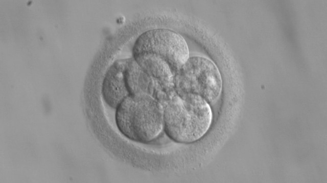 Eight little overlapping circles (cells) within a bigger circle