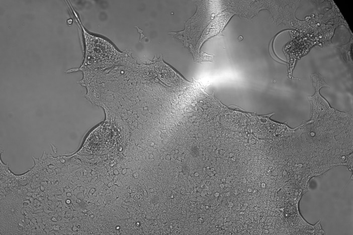 A virus under microscope