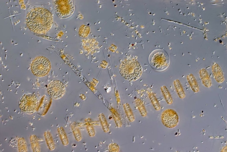 Phytoplankton seen under a microscope.