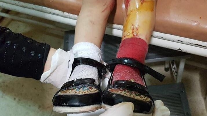 A child's bloodied shoes in Aleppo, Syria.