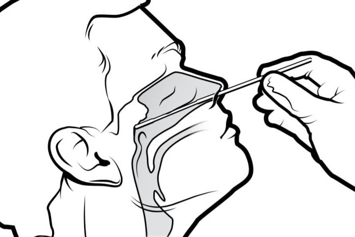 A black and white drawing of a swab going up someone's nose to the back of their throat.