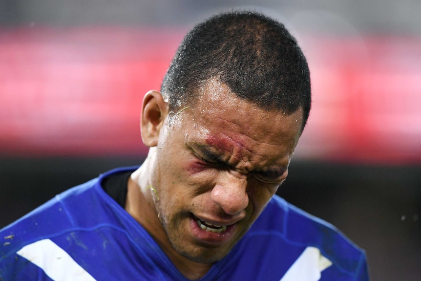 An injured Will Hopoate is assisted from the field during the Roosters' clash with the Bulldogs.