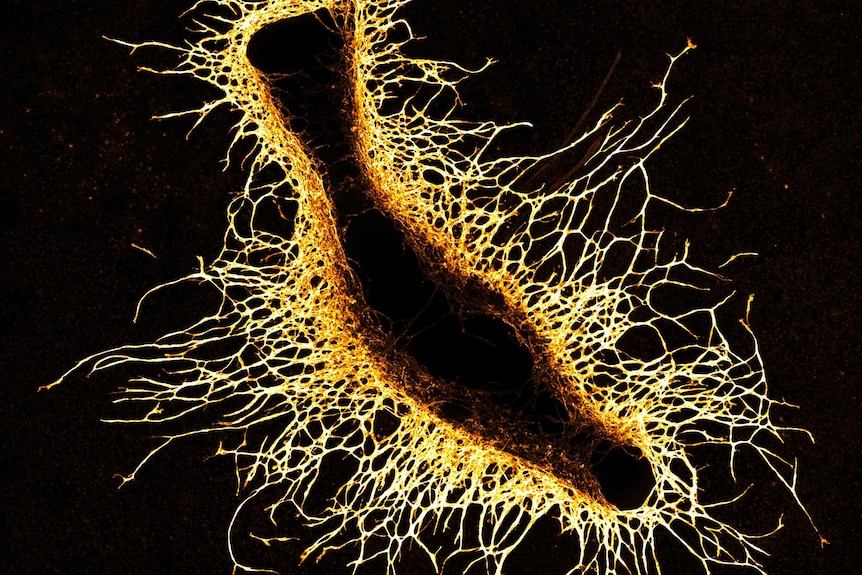 Microscopic image of bone and blood vessels.