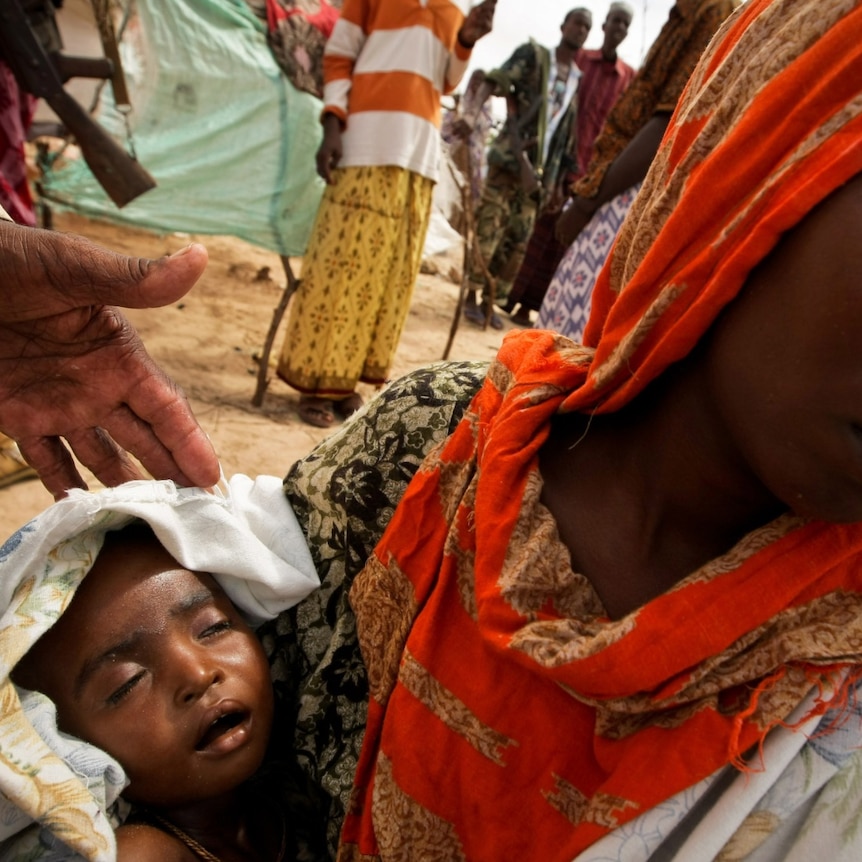 A woman holds her severely malnourished child in a camp for internally displaced people in Mogadishu.