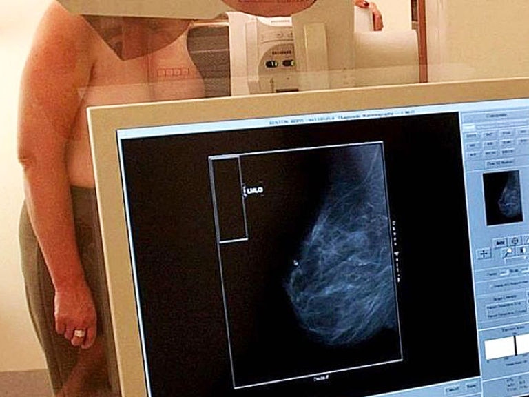 Mammograms had to be reviewed