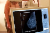 Mammograms had to be reviewed