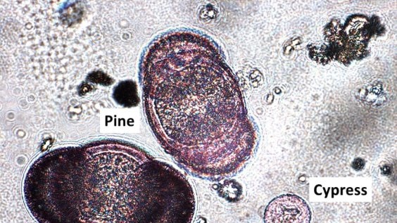 Microscopic view of a pollen sample from September 2016 in Canberra.