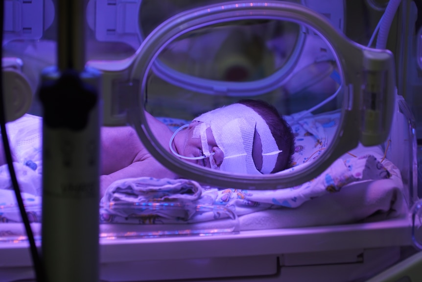 A small baby with medical tape over its eyes lays still in a hospital incubator.