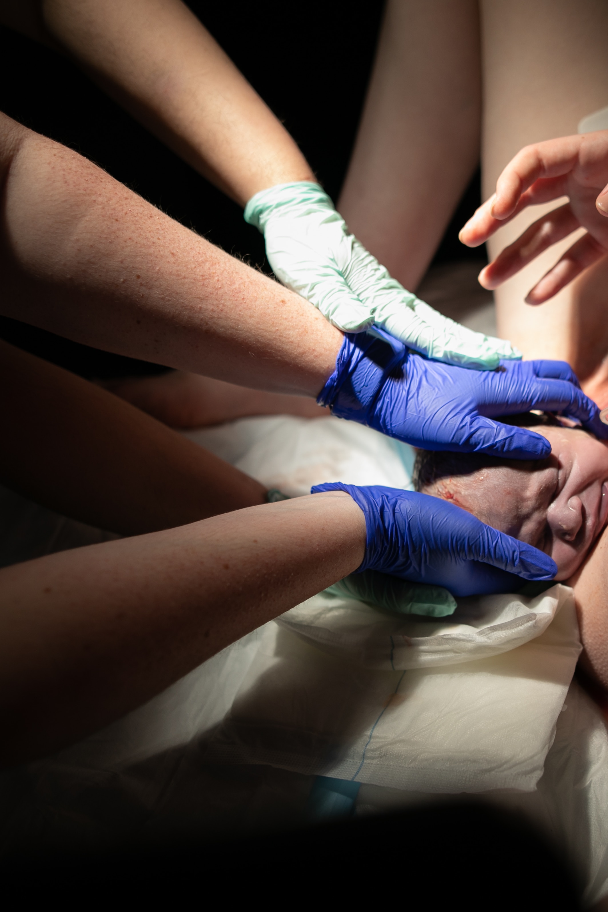 Two sets of gloved hands hold the head of a baby, its face scrunched up, while it is being born.