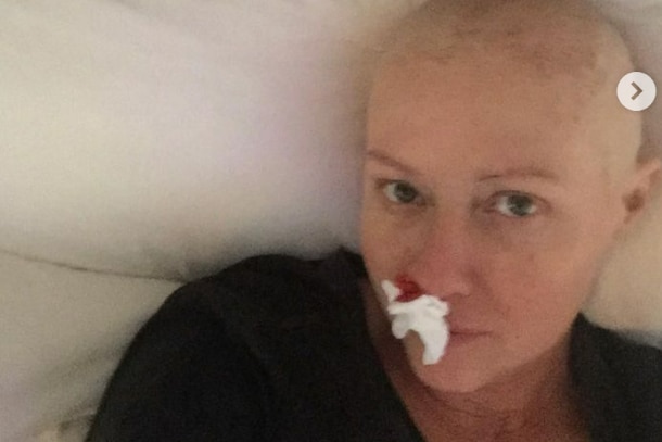 Shannen Doherty takes a selfie in bed, with a shaved head and a tissue soaking up a nosebleed. 